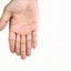 Hand comparison 8, baseline, original sample 0_5_73.png, finger-count error marked in the paper grid